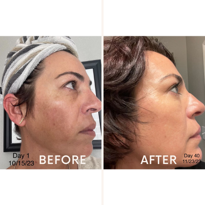 Skincare Junkie Discoloration Fade Wand Face Serums   