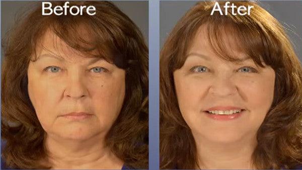 Art Harding Instant Face and Neck Lift Instant Face Treatments   